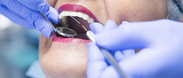 Best Emergency Treatment for Toothache in Bridgeport, CT